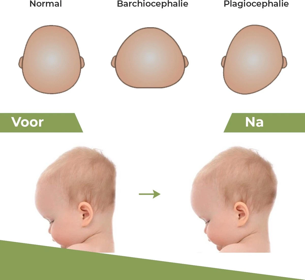 Novalits - Orthopedisch Baby Zijslaapkussen Met Traagschuim En Anti-Allergene Bamboe Microvezel Stof Om Een Plat Hoofd Tegen Te Gaan - Zijligkussen Voor Peuter - Babykussen Zijligging - Rolkussen - Steunkussen - Slaapondersteuning - Afbeelding 6